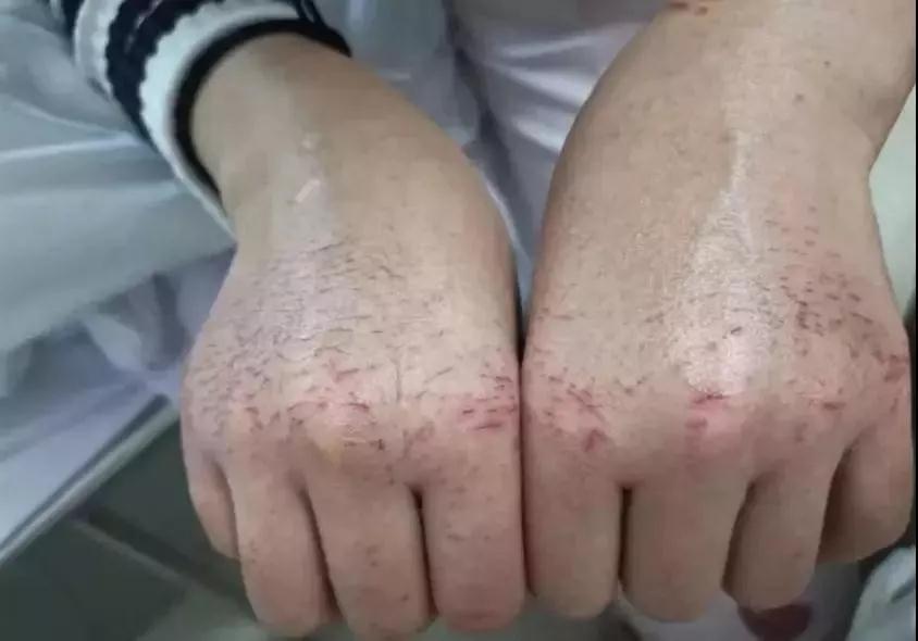 医护人员无惧风险，冲在抗击疫情第一线